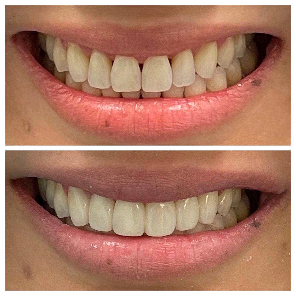 Top Cosmetic Dentist in North Richland Hills Texas Top Cosmetic Dentist in North Richland Hills Texas