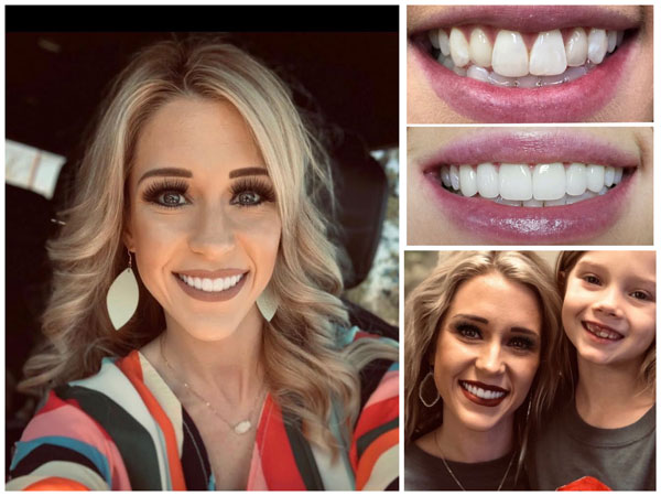 Cosmetic Dentist In Brookhaven Georgia