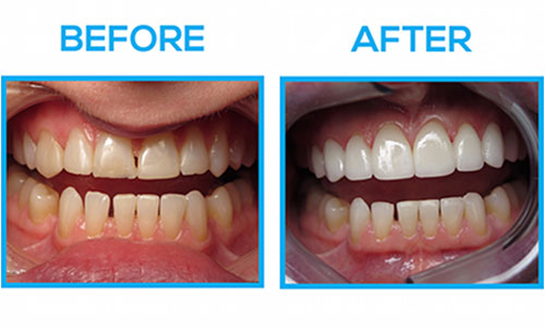 Top Rated Cosmetic Dentistry Near Me