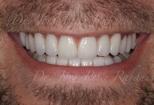 Top Rated Cosmetic Dentistry Near Me