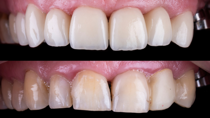 Cosmetic Dentist In Oak Lawn Illinois