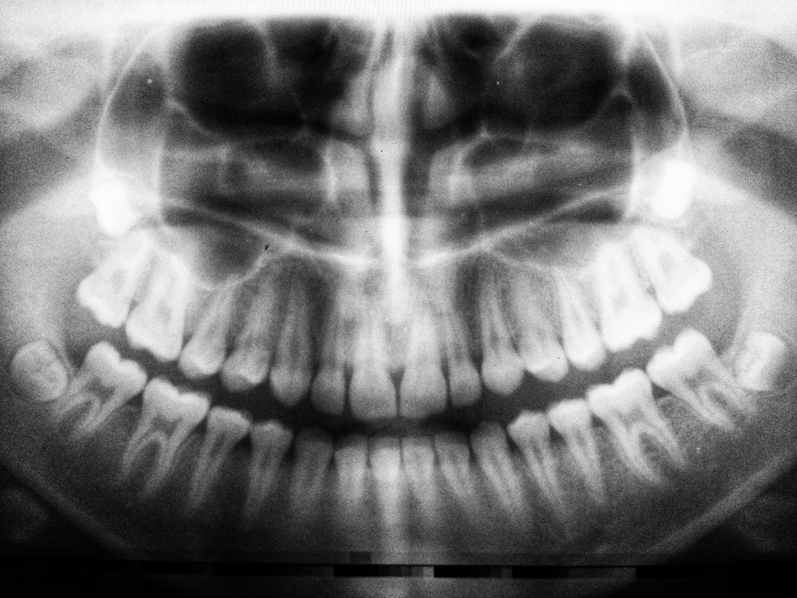 Cosmetic Dentist In Air Park Lincoln Nebraska Neb NE