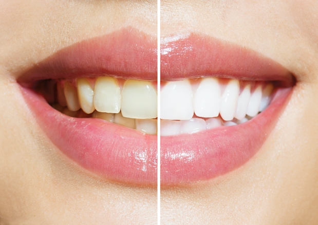 Cosmetic Dentist In Andersen Springs Chandler Arizona Ariz AZ Cosmetic Dentist In Andersen Springs Chandler Arizona Ariz AZ