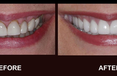 Cosmetic Dentist In Baker Adjacent To Baton Rouge Louisiana LA Cosmetic Dentist In Baker Adjacent To Baton Rouge Louisiana LA