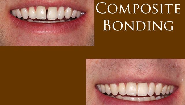 Cosmetic Dentist In Beachwood Adjacent To Cleveland Ohio OH Cosmetic Dentist In Beachwood Adjacent To Cleveland Ohio OH