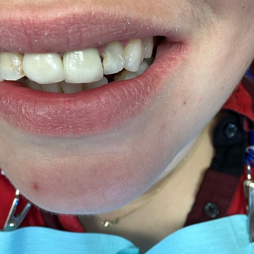 Cosmetic Dentist In Bergen Lafayette Jersey City New Jersey NJ