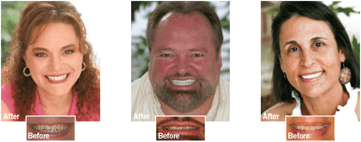 Cosmetic Dentist In Betton Hills Tallahassee Florida Fla FL Cosmetic Dentist In Betton Hills Tallahassee Florida Fla FL