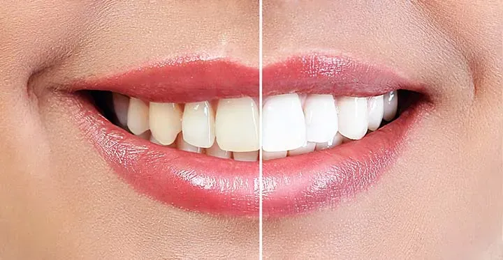Cosmetic Dentist In Beverly Toledo Ohio OH Cosmetic Dentist In Beverly Toledo Ohio OH
