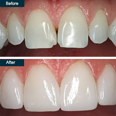 Cosmetic Dentist In Bryn Mawr Yonkers New York NY Cosmetic Dentist In Bryn Mawr Yonkers New York NY