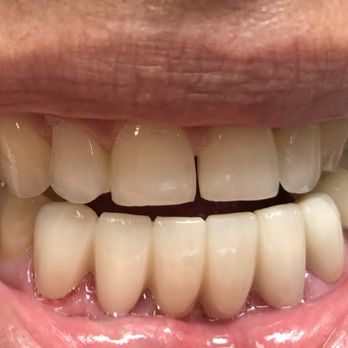 Cosmetic Dentist In Bullard Fresno California Calif CA