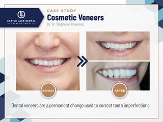 Cosmetic Dentist In Castle Hills Carrollton Texas TX