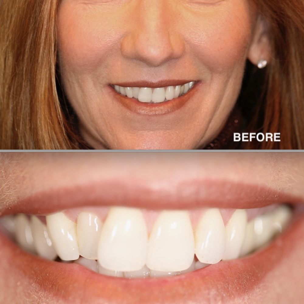 Cosmetic Dentist In Castro District San Francisco California Calif CA Cosmetic Dentist In Castro District San Francisco California Calif CA