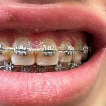 Cosmetic Dentist In Castro District San Francisco California Calif CA Cosmetic Dentist In Castro District San Francisco California Calif CA