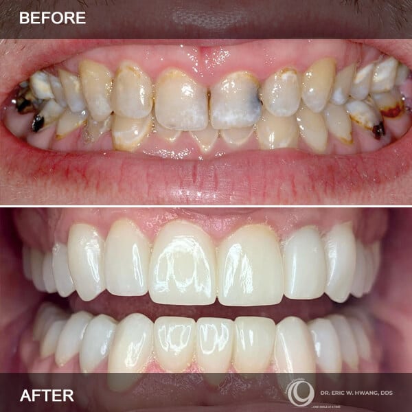 Cosmetic Dentist In Chandler Heights Chandler Arizona Ariz AZ Cosmetic Dentist In Chandler Heights Chandler Arizona Ariz AZ