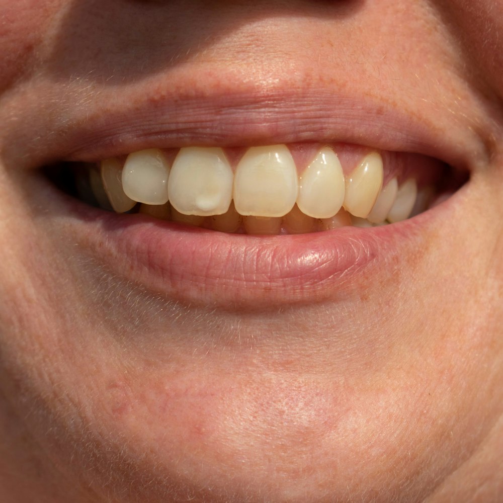 Cosmetic Dentist In Charlestown Boston Massachusetts Mass MA