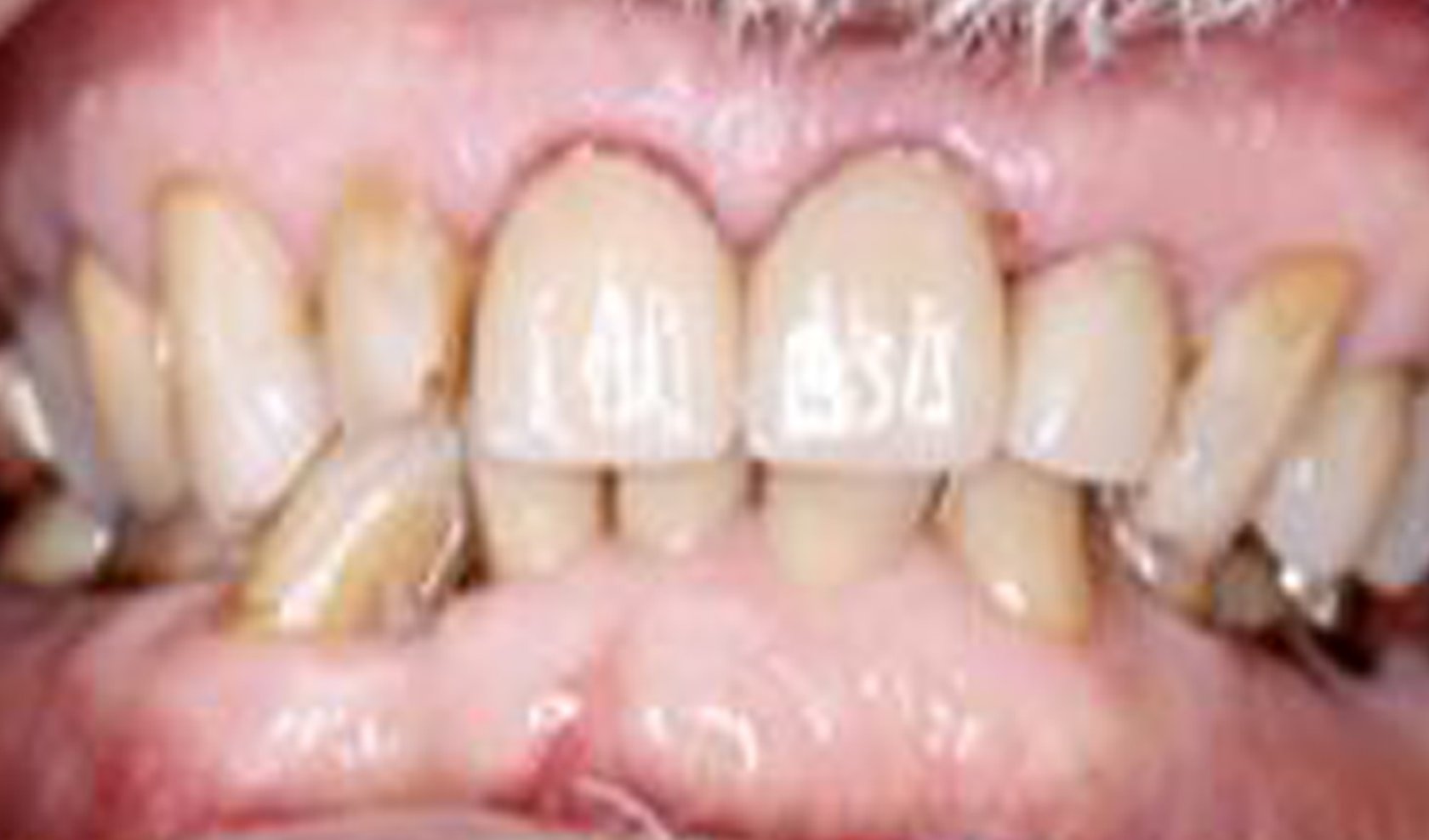 Cosmetic Dentist In Clear Lake/NASA Houston Texas TX Cosmetic Dentist In Clear Lake/NASA Houston Texas TX