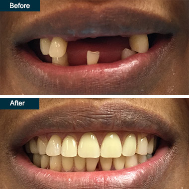Cosmetic Dentist In Colonial Heights Yonkers New York NY Cosmetic Dentist In Colonial Heights Yonkers New York NY