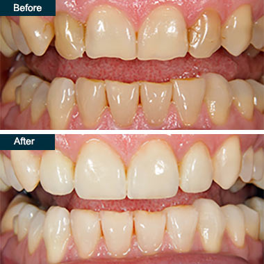 Cosmetic Dentist In Colonial Heights Yonkers New York NY Cosmetic Dentist In Colonial Heights Yonkers New York NY