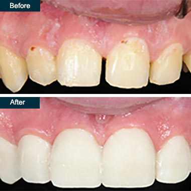 Cosmetic Dentist In Colonial Heights Yonkers New York NY Cosmetic Dentist In Colonial Heights Yonkers New York NY