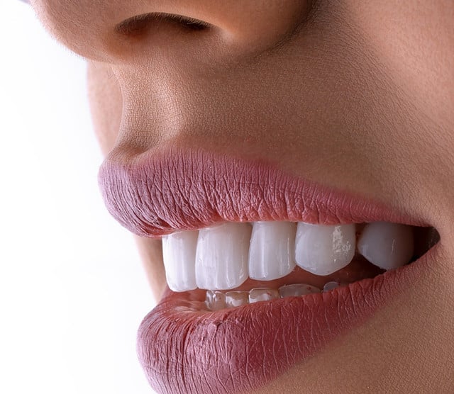 Cosmetic Dentist In Concord Pavilion Area Concord California Calif CA