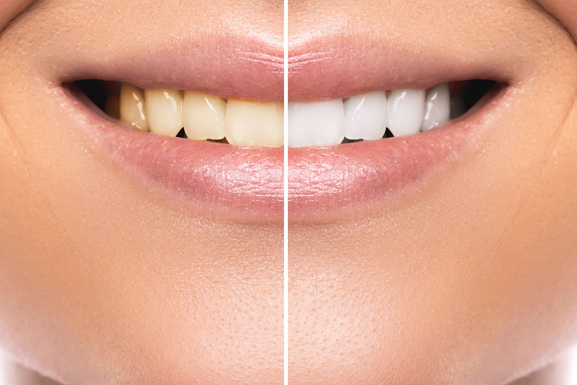 Cosmetic Dentist In Coral Gables Miami Florida Fla FL Cosmetic Dentist In Coral Gables Miami Florida Fla FL