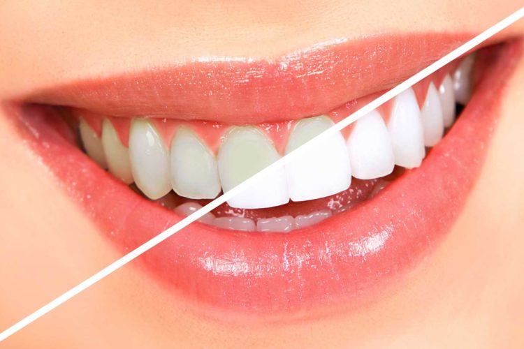 Cosmetic Dentist In Crown Heights Wichita Kansas Kan KS Cosmetic Dentist In Crown Heights Wichita Kansas Kan KS