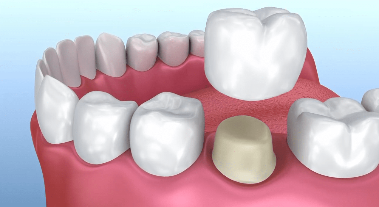 Cosmetic Dentist In Crown Heights Wichita Kansas Kan KS Cosmetic Dentist In Crown Heights Wichita Kansas Kan KS