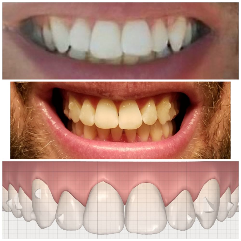 Cosmetic Dentist In Cuyahoga Falls Adjacent To Akron Ohio OH Cosmetic Dentist In Cuyahoga Falls Adjacent To Akron Ohio OH