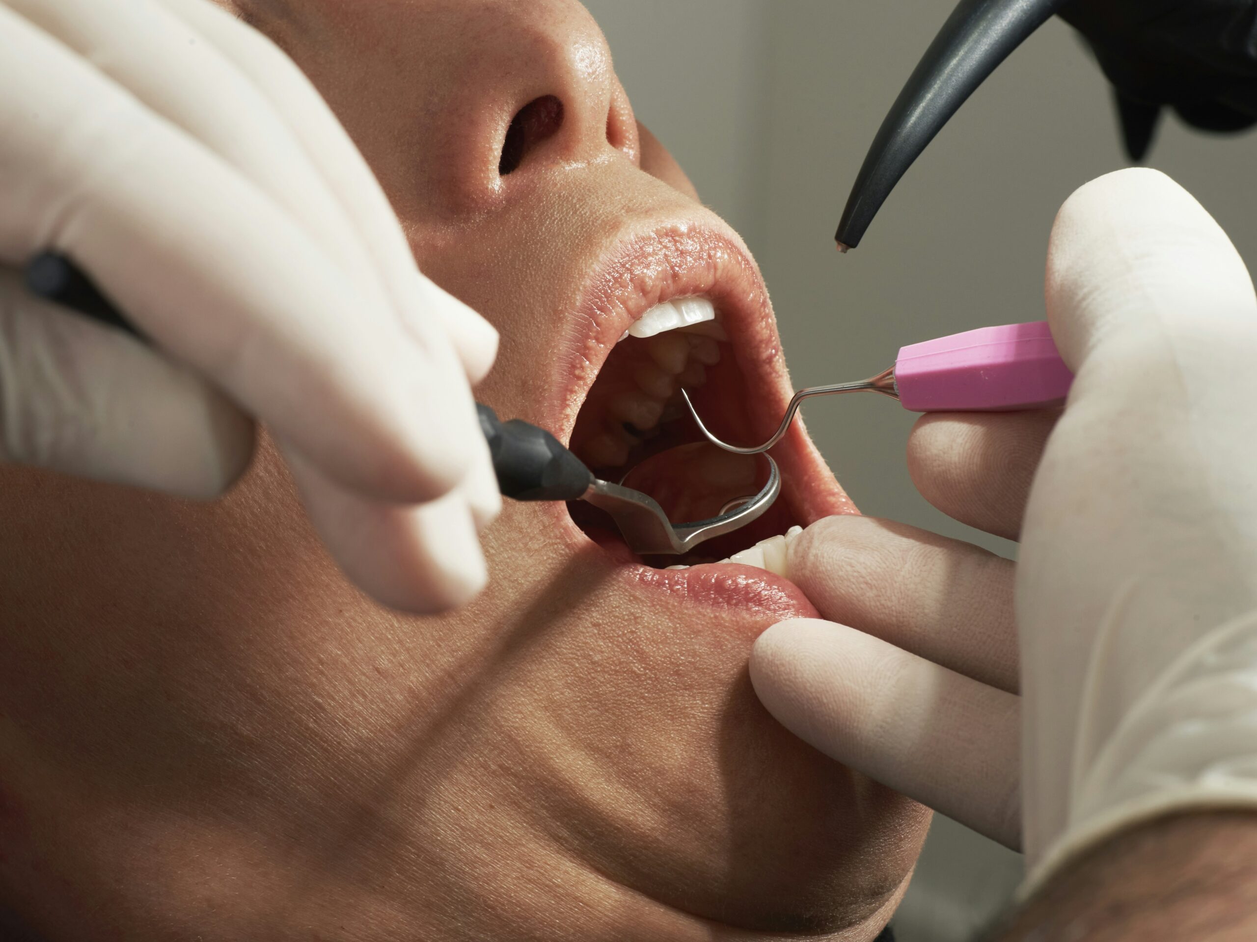 Cosmetic Dentist In Downtown Honolulu Hawaii HI