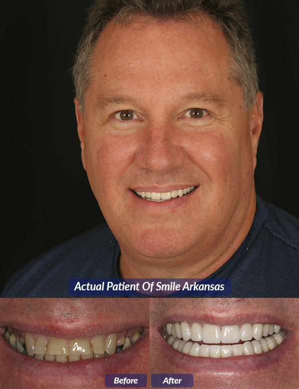 Cosmetic Dentist In Downtown Little Rock Arkansas Ark AR Cosmetic Dentist In Downtown Little Rock Arkansas Ark AR