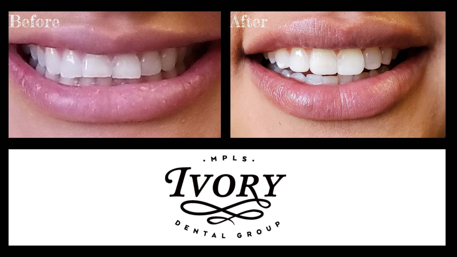 Cosmetic Dentist In Downtown Minneapolis Minnesota Minn MN Cosmetic Dentist In Downtown Minneapolis Minnesota Minn MN