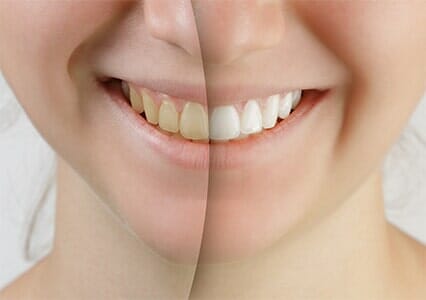 Cosmetic Dentist In Downtown Newport News Virginia VA Cosmetic Dentist In Downtown Newport News Virginia VA