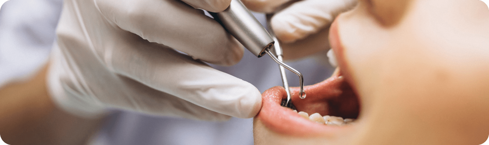 Cosmetic Dentist In Downtown Orlando Florida Fla FL Cosmetic Dentist In Downtown Orlando Florida Fla FL
