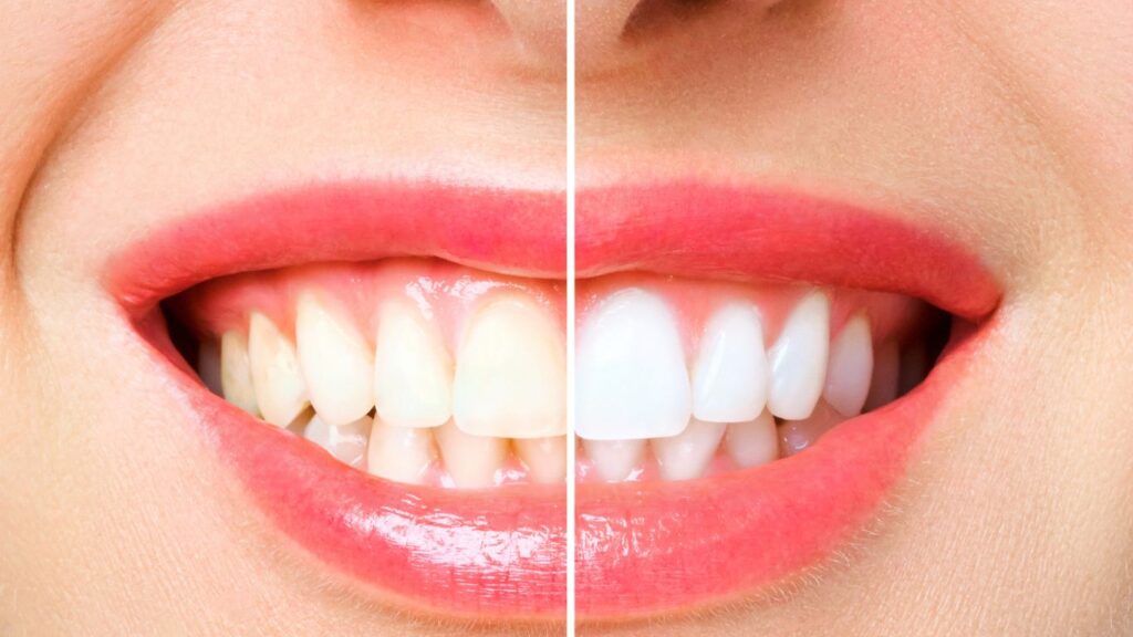 Cosmetic Dentist In Downtown Portland Oregon Ore OR Cosmetic Dentist In Downtown Portland Oregon Ore OR
