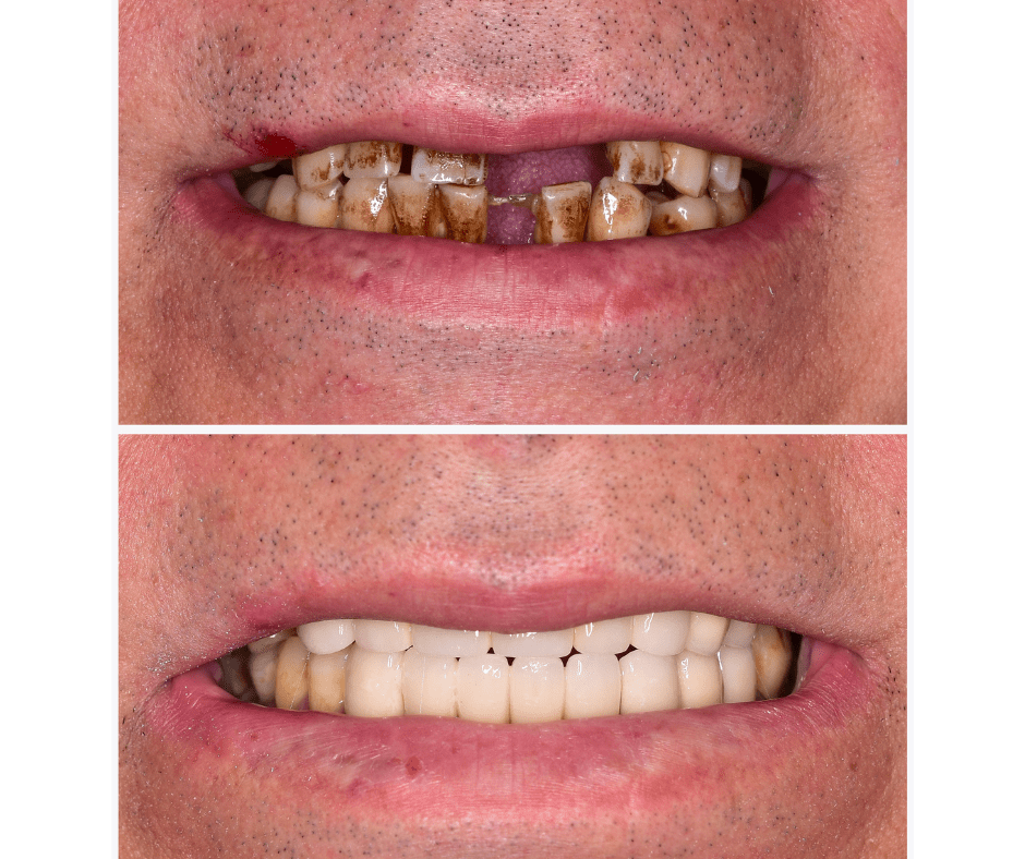 Cosmetic Dentist In Downtown Sacramento California Calif CA Cosmetic Dentist In Downtown Sacramento California Calif CA