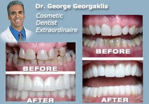 Cosmetic Dentist In Downtown San Diego California Calif CA