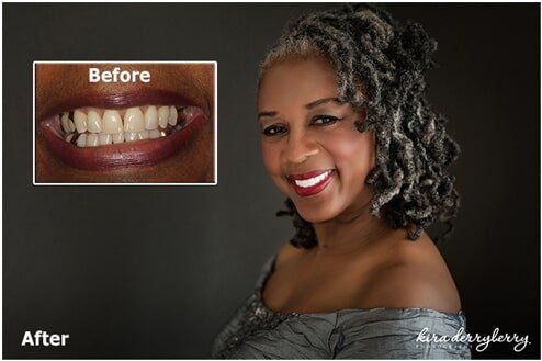 Cosmetic Dentist In Downtown Tallahassee Florida Fla FL Cosmetic Dentist In Downtown Tallahassee Florida Fla FL