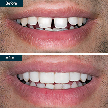 Cosmetic Dentist In Downtown Yonkers New York NY Cosmetic Dentist In Downtown Yonkers New York NY