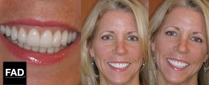 Cosmetic Dentist In East Cleveland Ohio OH