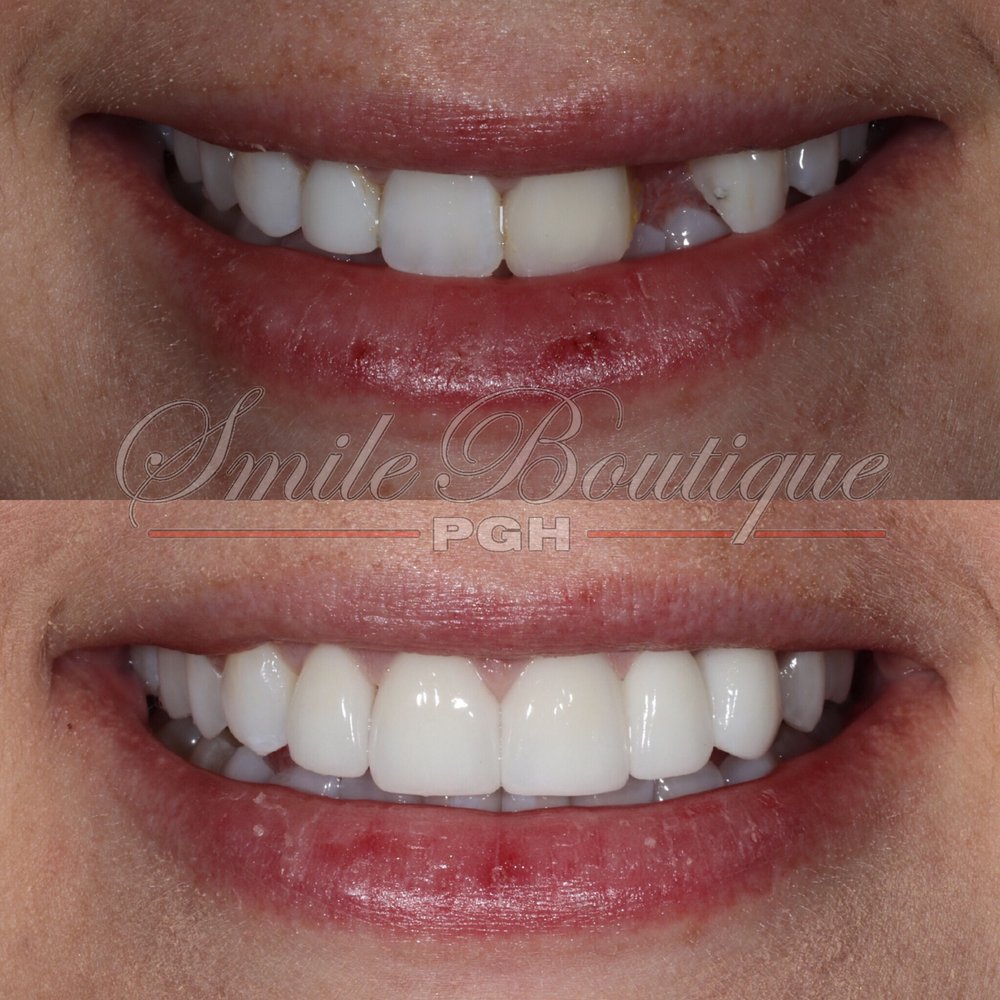 Cosmetic Dentist In East Liberty Pittsburgh Pennsylvania PA