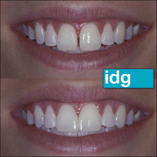 Cosmetic Dentist In East Village Des Moines Iowa IA Cosmetic Dentist In East Village Des Moines Iowa IA