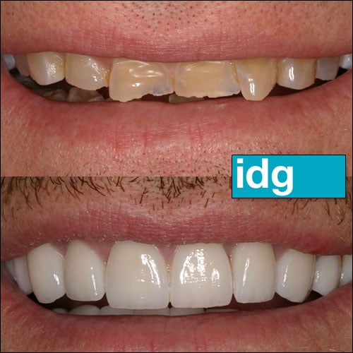 Cosmetic Dentist In East Village Des Moines Iowa IA Cosmetic Dentist In East Village Des Moines Iowa IA