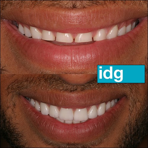 Cosmetic Dentist In East Village Des Moines Iowa IA Cosmetic Dentist In East Village Des Moines Iowa IA