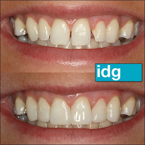 Cosmetic Dentist In East Village Des Moines Iowa IA Cosmetic Dentist In East Village Des Moines Iowa IA