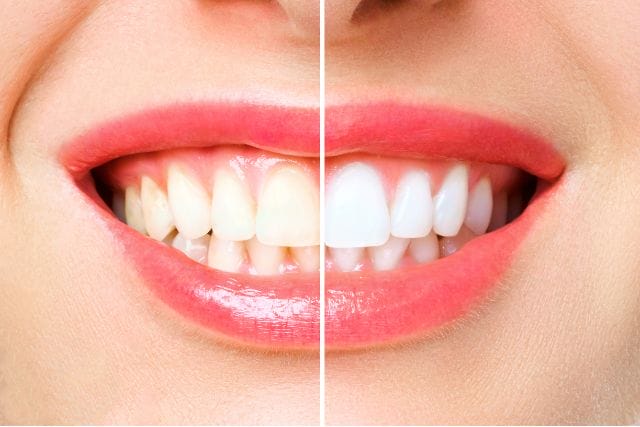 Cosmetic Dentist In Eastside Tucson Arizona Ariz AZ Cosmetic Dentist In Eastside Tucson Arizona Ariz AZ