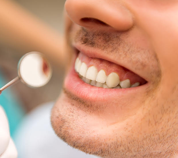 Cosmetic Dentist In Eastside Tucson Arizona Ariz AZ Cosmetic Dentist In Eastside Tucson Arizona Ariz AZ