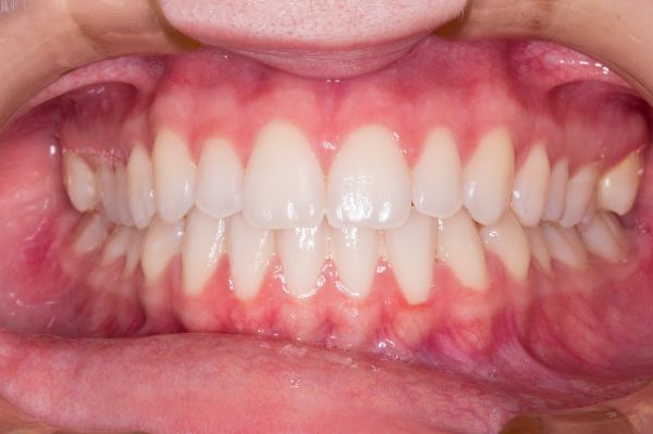 Cosmetic Dentist In Eastwood Irvine California Calif CA Cosmetic Dentist In Eastwood Irvine California Calif CA