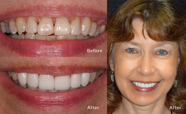 Cosmetic Dentist In Fitchburg Adjacent To Madison Wisconsin Wis WI