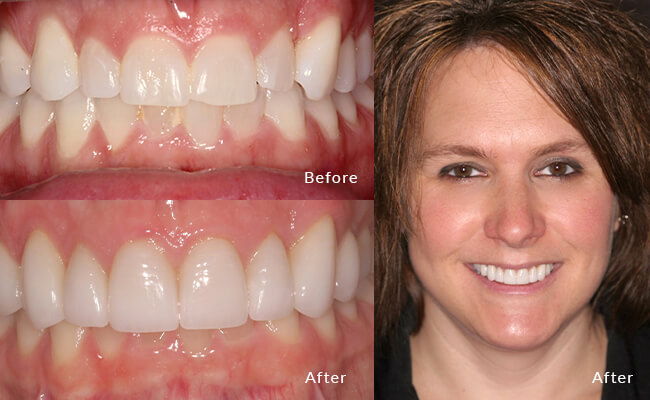 Cosmetic Dentist In Fitchburg Adjacent To Madison Wisconsin Wis WI