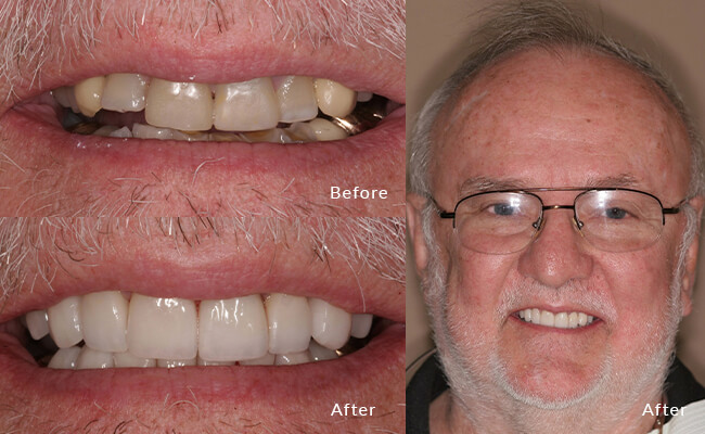 Cosmetic Dentist In Fitchburg Adjacent To Madison Wisconsin Wis WI